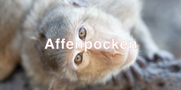 Affenpocken: So schützt du dich als Pflegekraft